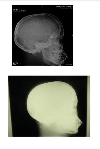 <p>the top is better than bottom</p><p>bottom is under exposure</p>