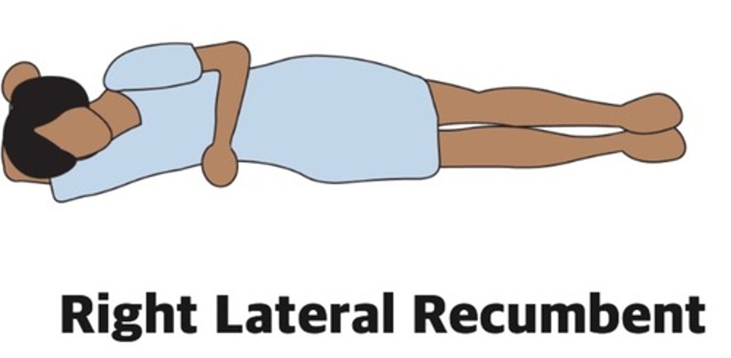 <p>Right lateral recumbent decubitus (echo)</p>