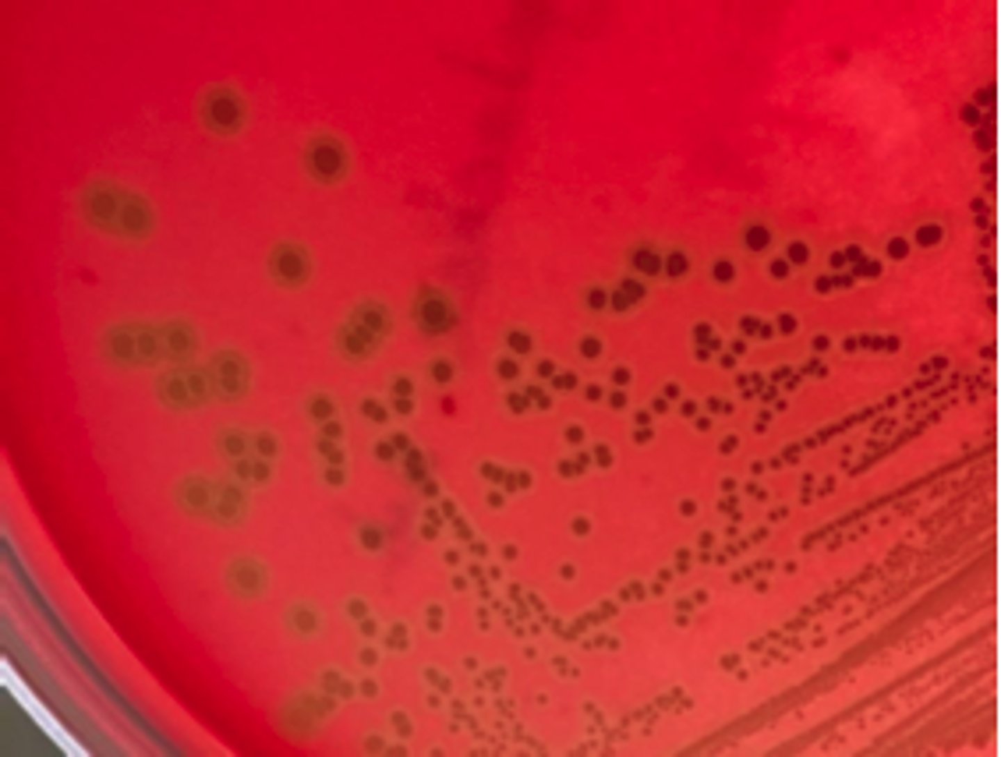 <p>Joint fluids from a few slaughter pigs showing signs of arthritis and/or valvular endocarditis were</p><p>collected using sterile swabs and submitted for standard aerobic culture. BA and MAC plates were</p><p>inoculated and grown overnight at 350C. There was no growth on MAC. What is your presumptive</p><p>identification and why?</p>