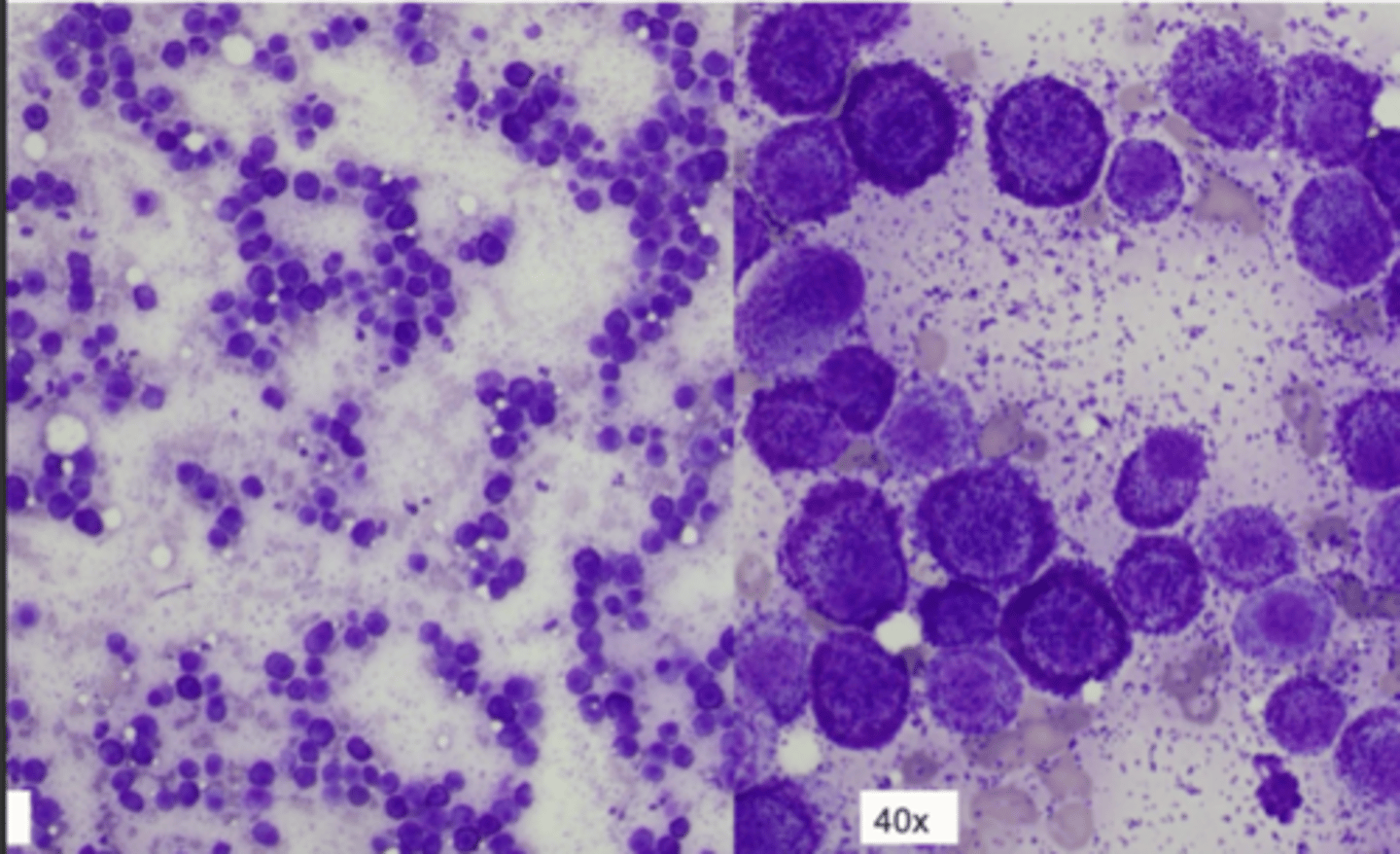 <p>Case 1 - Cytology</p><p>1. how populated with cells is this image</p><p>2. how are cells distributed/ what pattern</p><p>3. what is the shape of these cells</p><p>4. what cell category</p><p>5. what type of cell are they</p>
