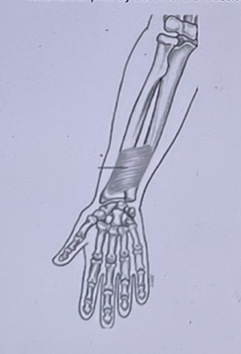 What is the primary action of the muscle in the figure below? 