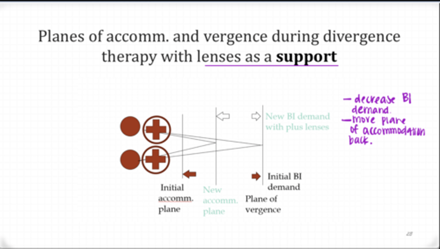 <p>What happens when plus lenses are added during Divergence Therapy?</p>