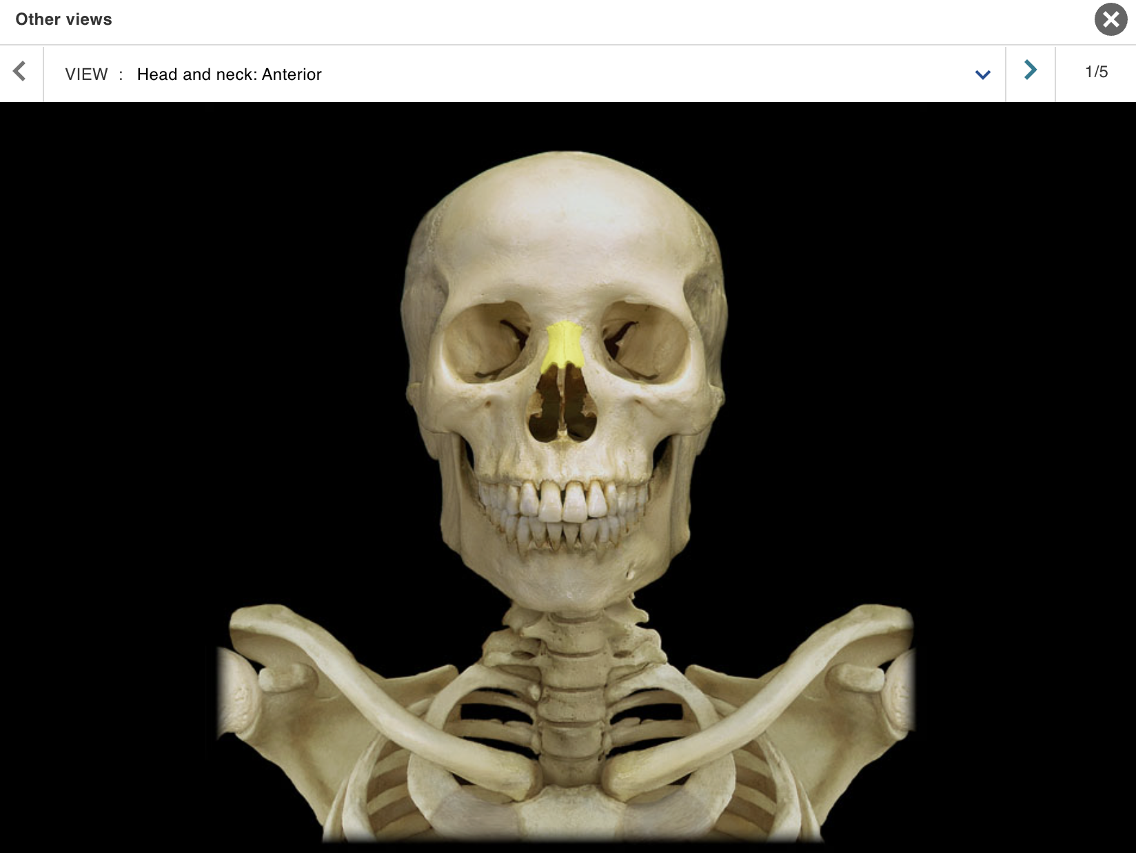 <p>Location:</p><p class="p1">• Skull (anterior)</p><p class="p1">Description:</p><ul><li><p>﻿﻿Small, paired bone</p></li><li><p>﻿﻿Articulates at midline with nasal bone from opposite side</p></li></ul><p class="p1">Also known as:</p><p class="p1">• "Bridge of nose"</p><p class="p1">Comment:</p><p class="p1">• Forms bony part of nose</p>