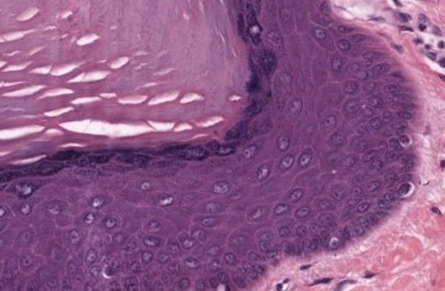 <p>thick skin</p>