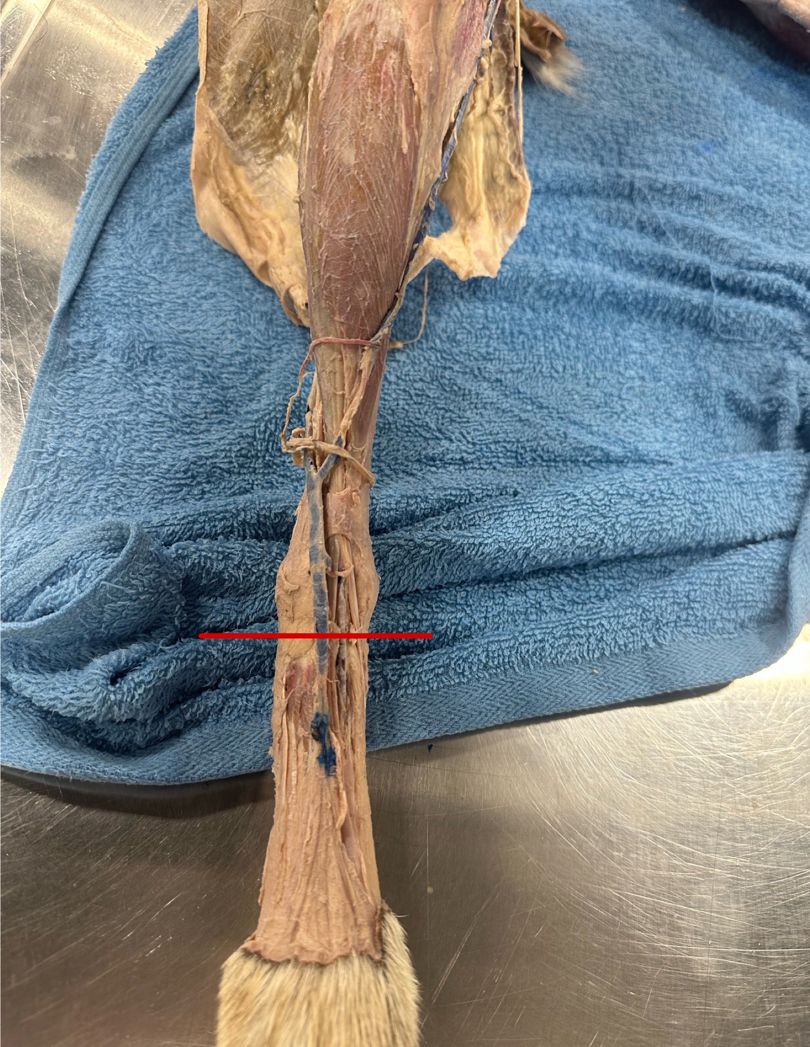 <p>When performing a dissection you accidentally cut the labeled vein</p><ul><li><p>what is this vein </p></li></ul><ul><li><p> What vein might we see bleed due to this cut</p></li></ul><p></p>