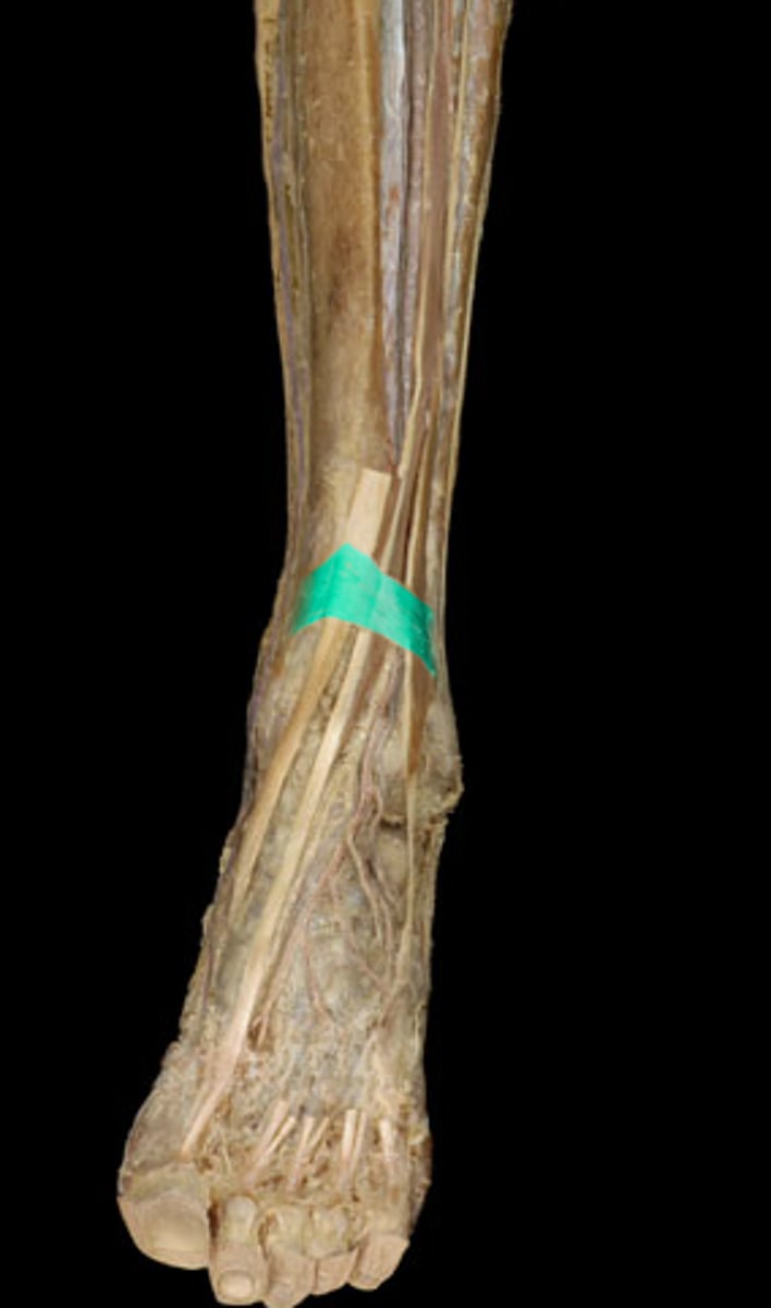 <p>Transverse ligament of the ankle.</p>