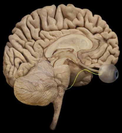 term image