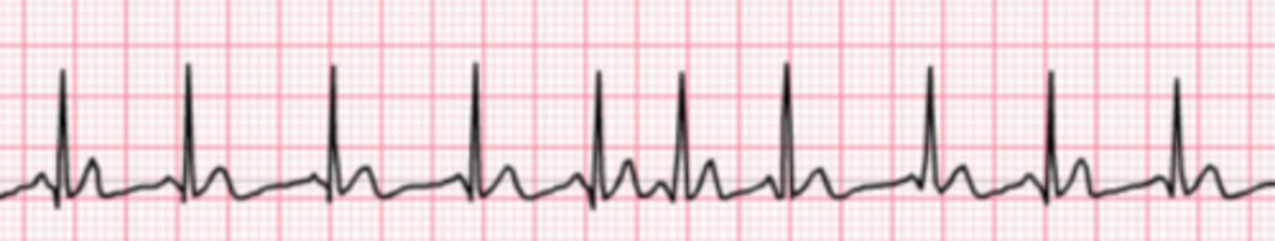 <p>Name the rhythm</p>