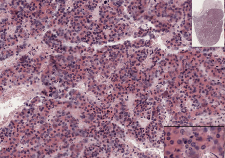 <p>What organ specimen is shown in this slide?</p>