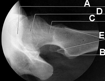 On the radiograph below, the letter "E" identifies the: