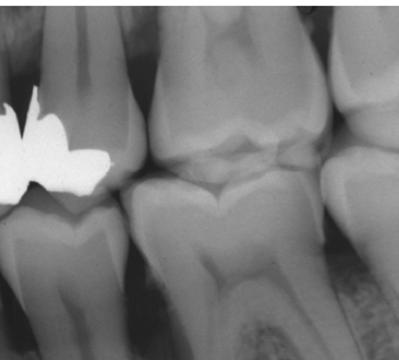 <p>Whats wrong w/ restoration?</p>