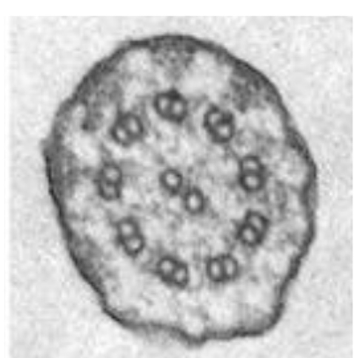 <p>True or False: The high magnification image on the right could be across section through a cilium of Paramecium</p>