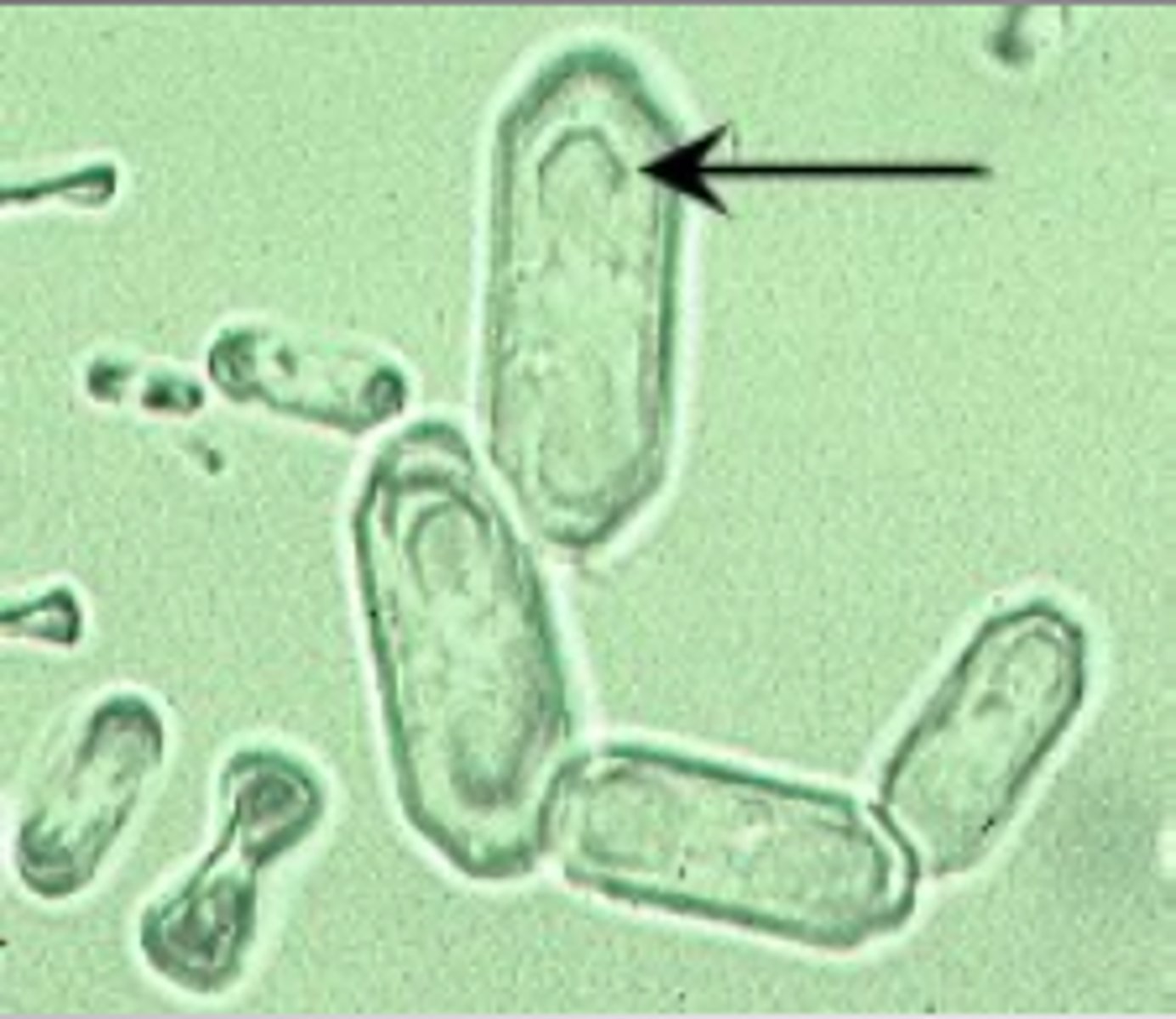 <p>Oval, dumbbell, can be found in both normal and abnormal urine and in a range of pH levels from acidic to neutral.</p>