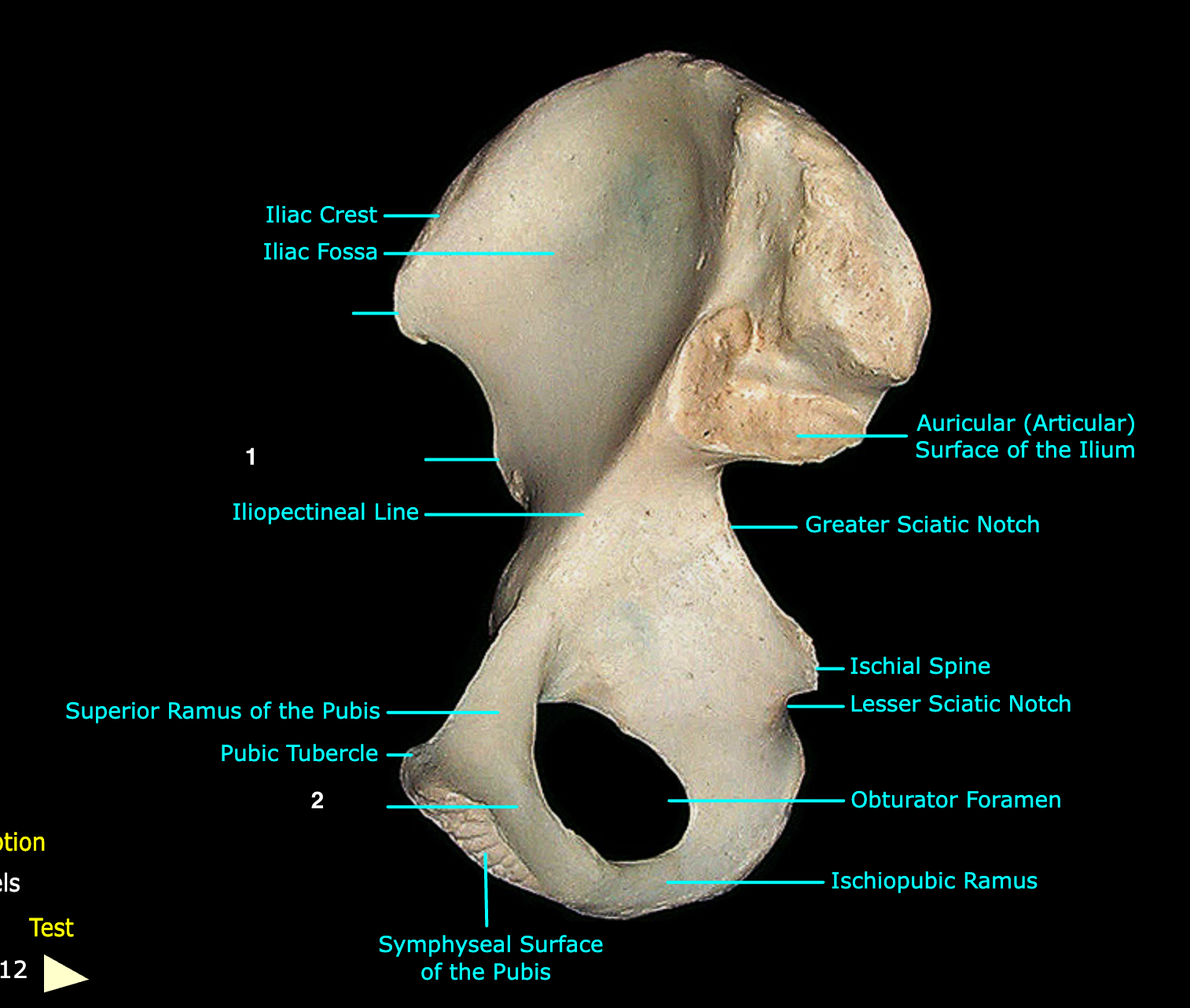 <p>What structure is labeled 2?</p>