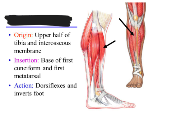 <p>Origin: Upper half of tibia and interosseous membrane</p><p>Insertion: Base of first cuneiform and first metatarsal</p><p>Action: Dorsiflexes and inverts foot</p>