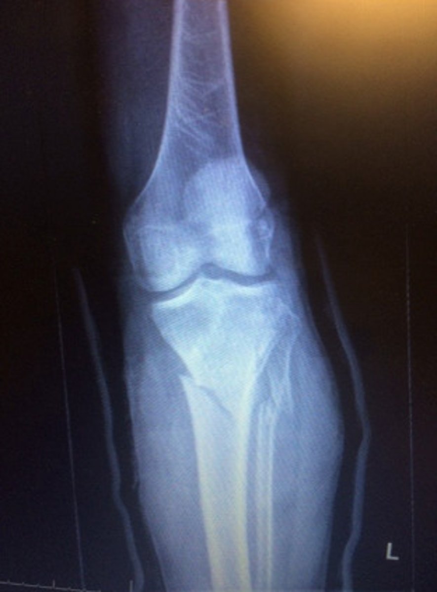 <p>Complete fx</p>