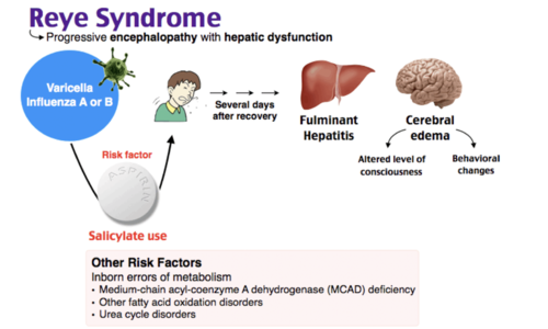 Reye's syndrome