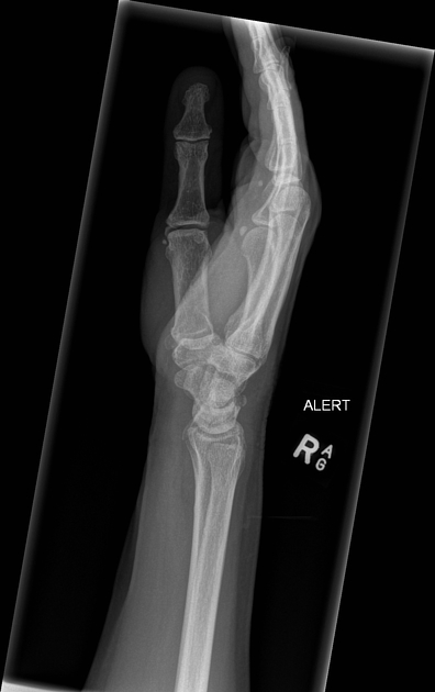 <p>Describe the abnormality demonstrated.</p>