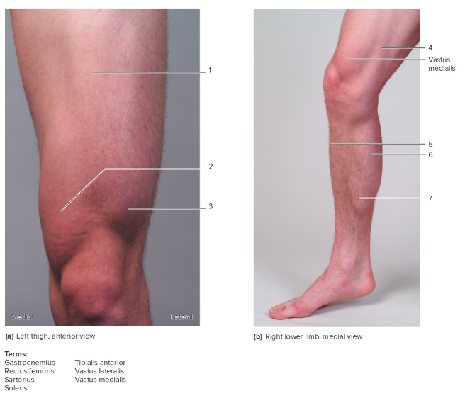 <p>Label the following: Lower limb</p>