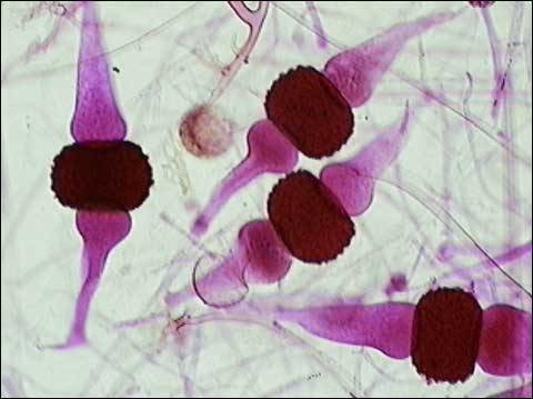 saprobes (eats dead nutrients)
Zygote Fungi
Ex. Rhizopus bread mold