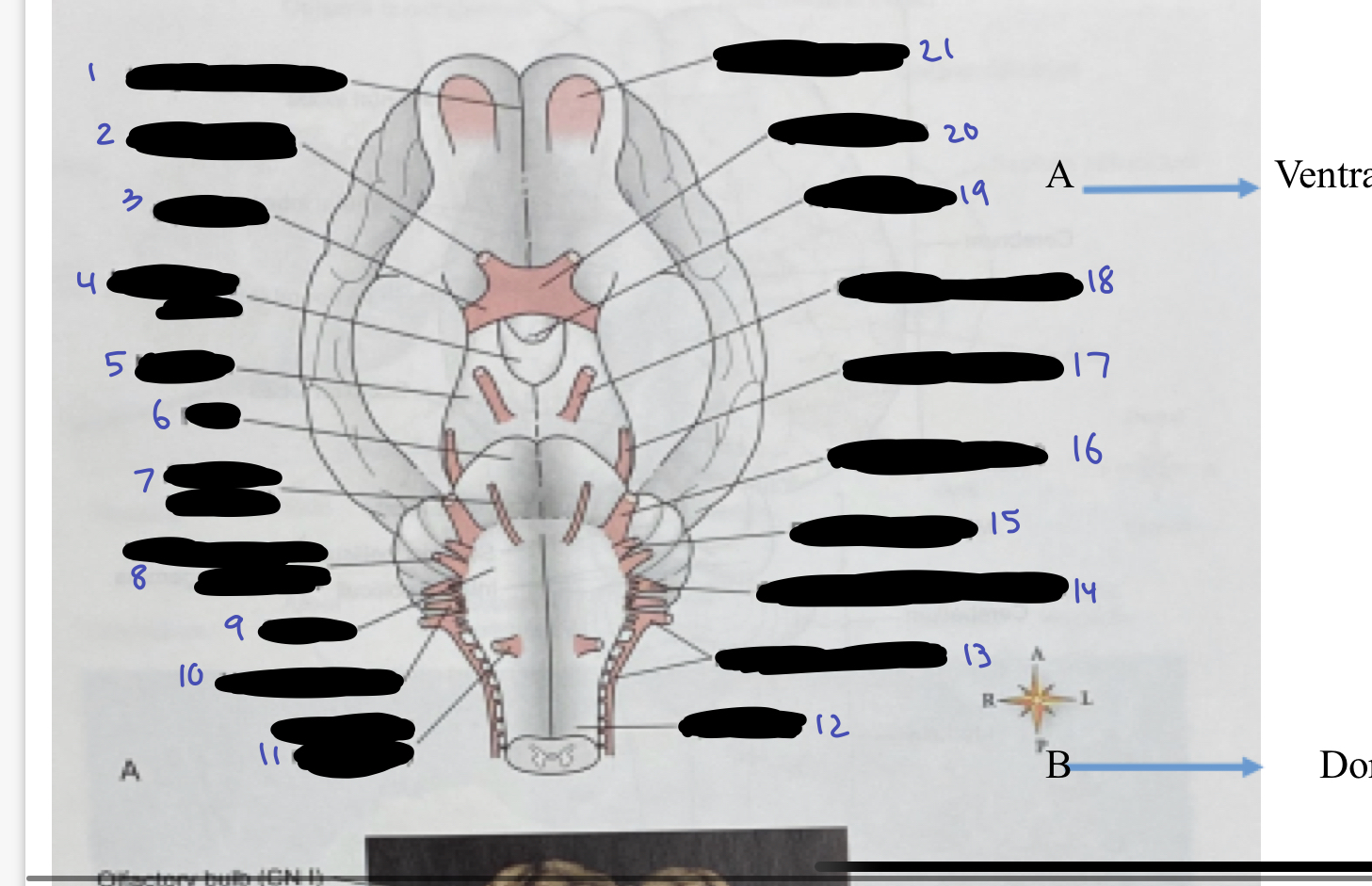 <ol><li><p>longitudinal fissure</p></li></ol><p>3 optic tract</p><p>4 mammillary bodies</p><p>5 midbrain</p><p>6 pons</p><p>9. medulla</p><p>12. spinal cord</p><p>19. infundibulum</p><p>20. optic chiasma</p>