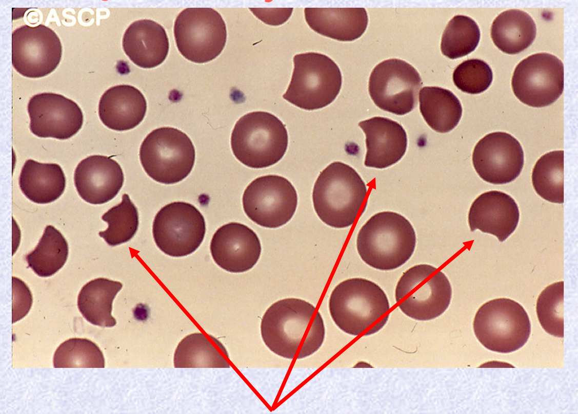 <p>What cell type &amp; stain type is in the image?</p>