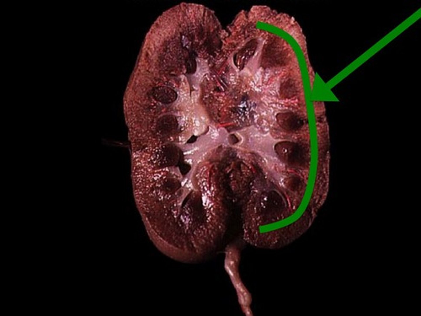 <p>Outer layer of kidney.</p>