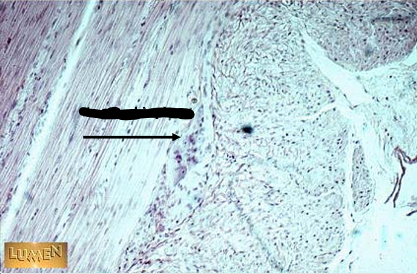 <p>the arrow points to</p>