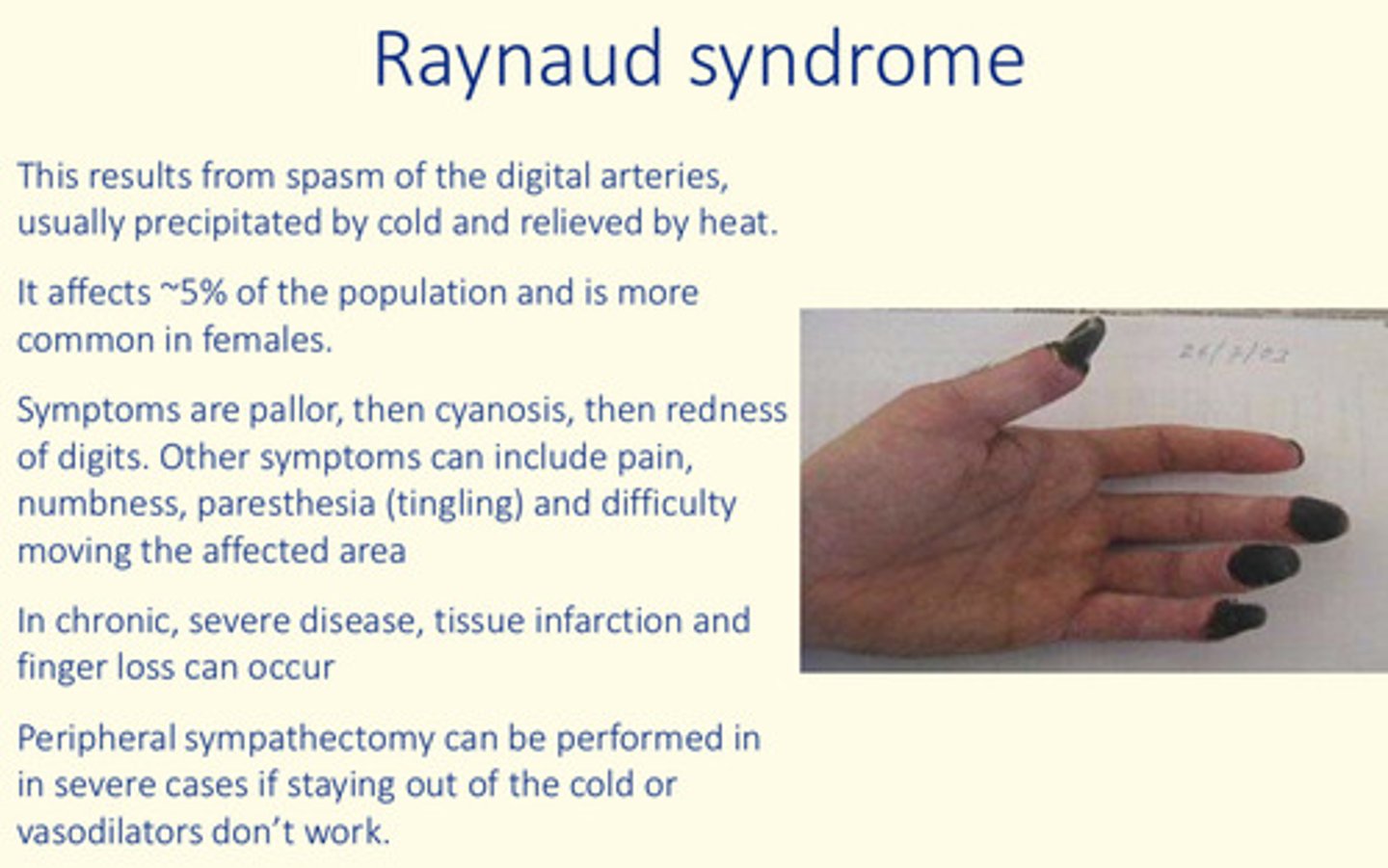 <p>Extreme case of vasoconstriction is Raynaud’s syndrome</p>