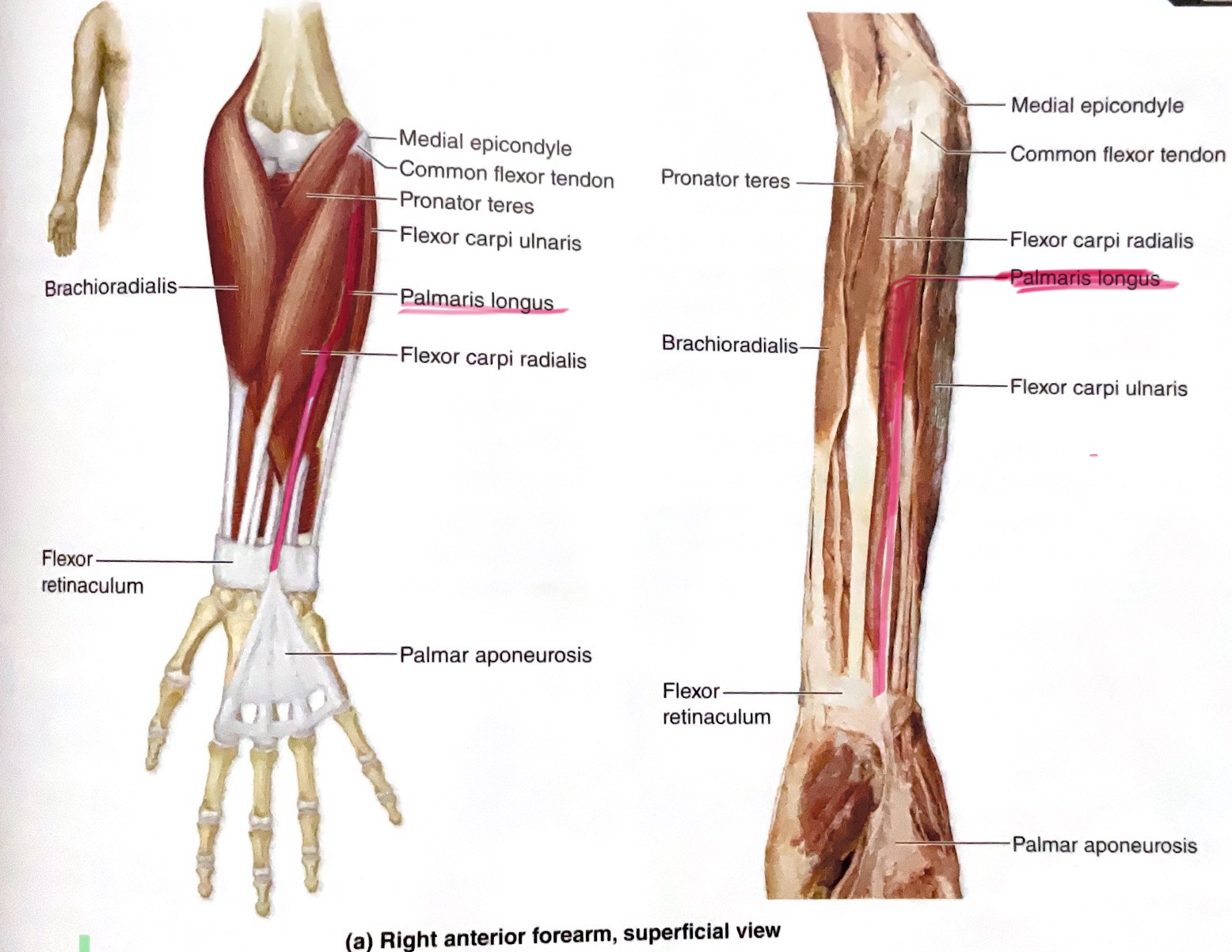 <p>Action: Flex wrist </p>