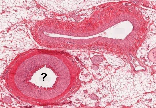 <p>Is this a vein or an artery?</p>