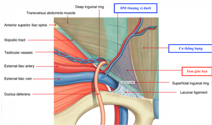 <p>B. Trong thừng tinh có dây chằng phúc tinh mạc</p><ul data-type="taskList"><li data-checked="true" data-type="taskItem"><label><input type="checkbox" checked="checked"><span></span></label><div><p>A. Lỗ bẹn nông có thể sờ thấy khi thăm khám</p></div></li><li data-checked="true" data-type="taskItem"><label><input type="checkbox" checked="checked"><span></span></label><div><p>C. Bó mạch thượng vị dưới nằm phía <u>trong</u> so với lỗ bẹn sâu</p></div></li><li data-checked="true" data-type="taskItem"><label><input type="checkbox" checked="checked"><span></span></label><div><p>D. Ở nữ trong ống bẹn có <u>dây chằng tròn</u>, ở nam trong ống bẹn có <u>thừng tinh</u></p></div></li></ul><p></p>
