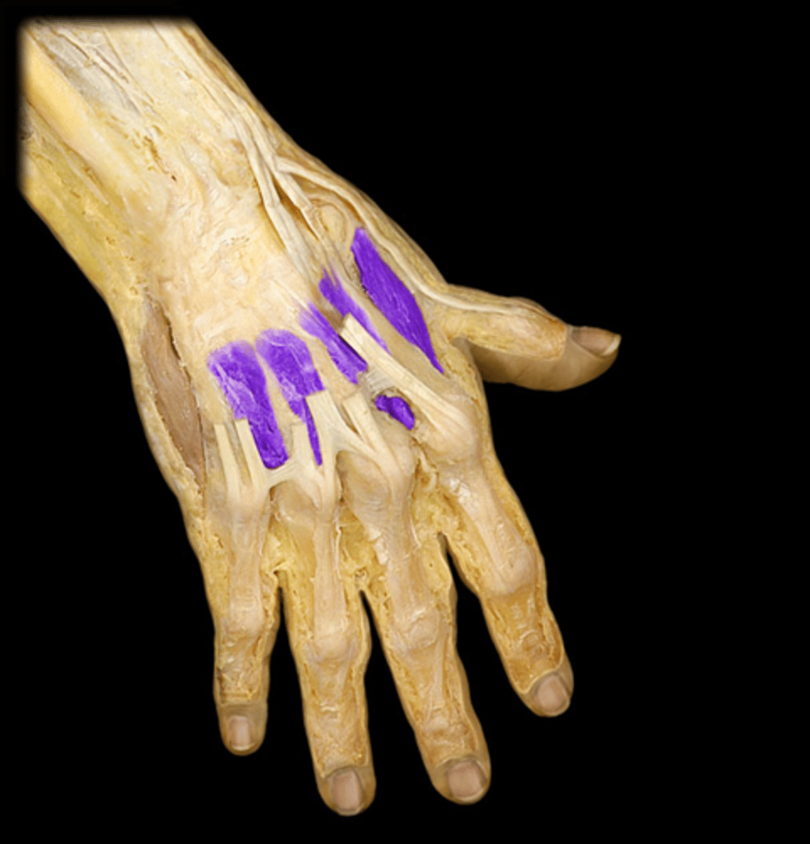 <p>adjacent sides of metacarpals</p>