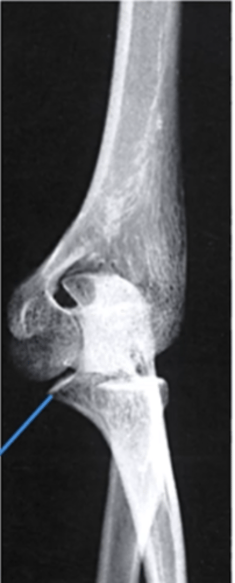 <p>What does the blue line point to?</p>