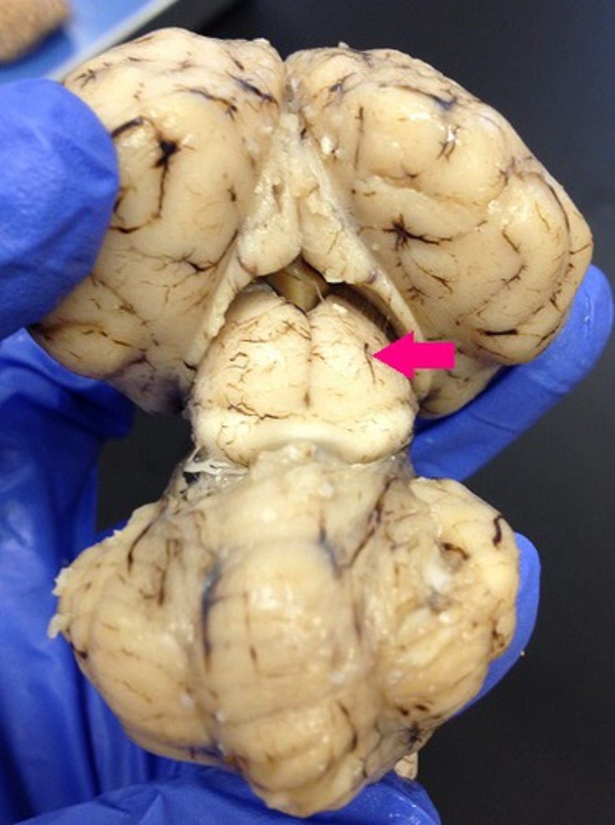 <p>Identify the structure (dorsal view of midbrain).</p>