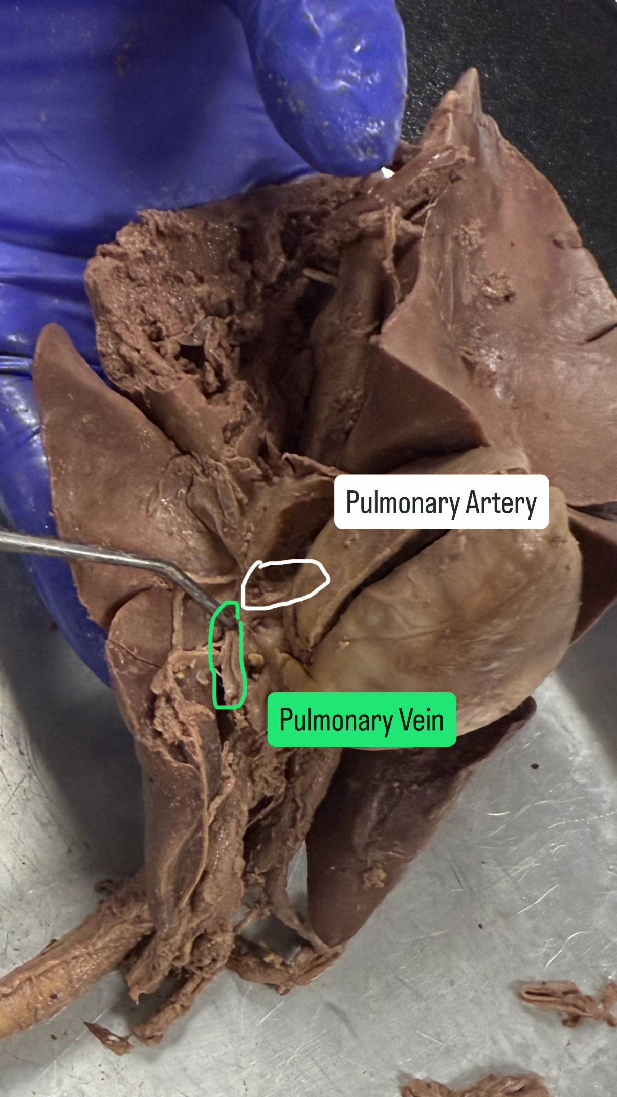 <p>Pulmonary artery and vein</p>