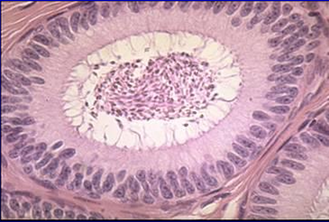 <p>Identify the structure:</p><p>Lining epithelium is provided with:</p><p>Lumen contains:</p>