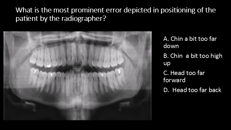 <p>What is the most prominent error depicted in positioning of the patient by the radiographer?</p><p>A. Chin a bit too far down</p><p>B. Chin  a bit too high up</p><p>C. Head too far forward</p><p>D.  Head too far back</p>