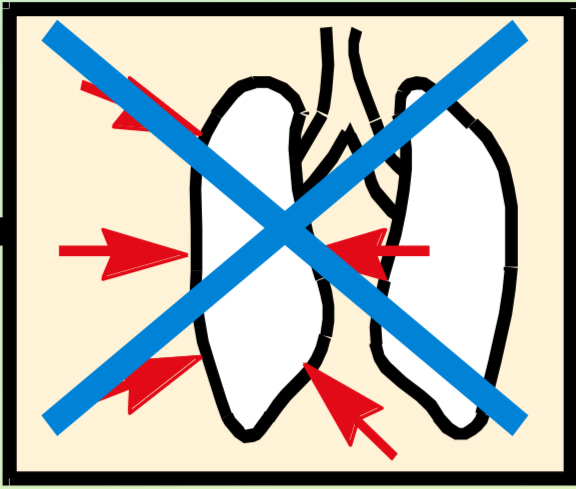 <p>Arrêt respiratoire</p>