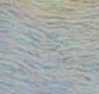 <p>Which type of tissue does this image depict?</p>