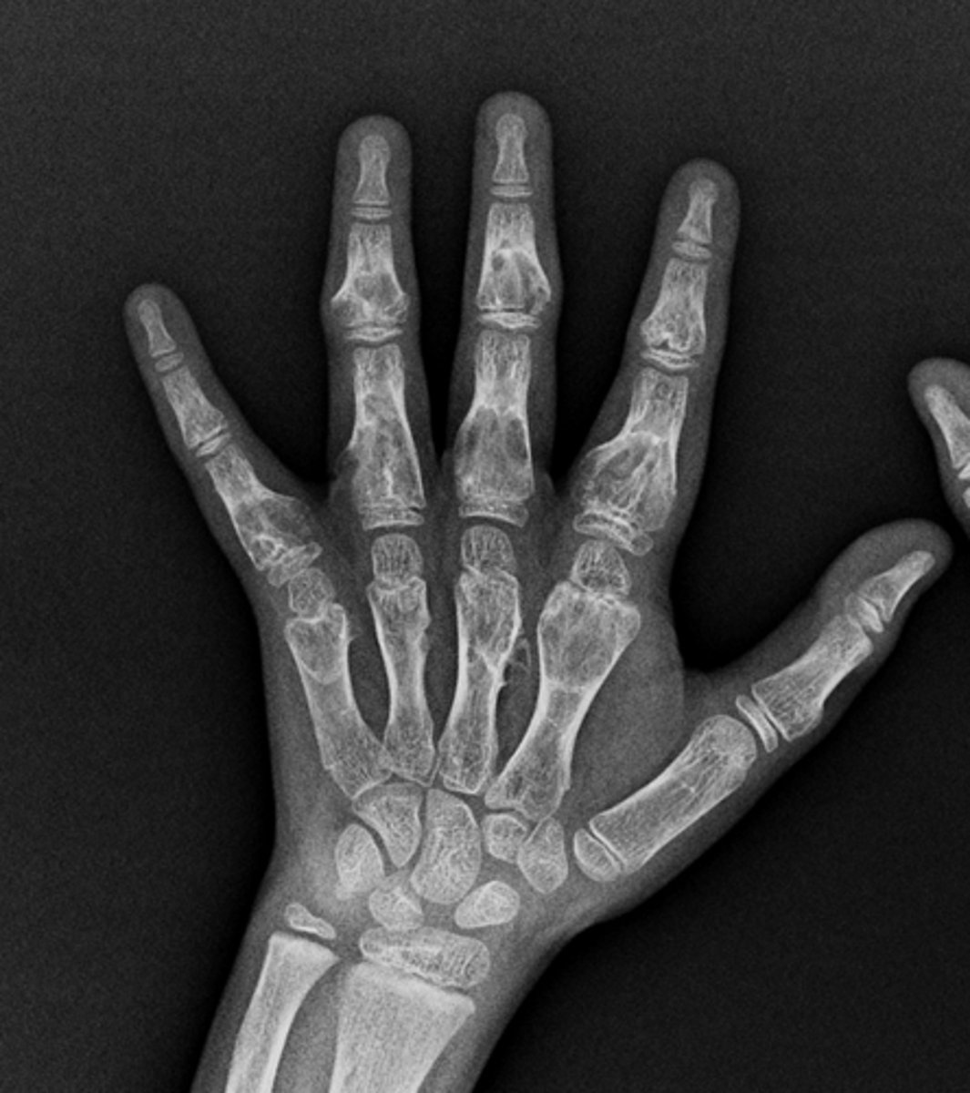 <p>Concerns/complications?</p>