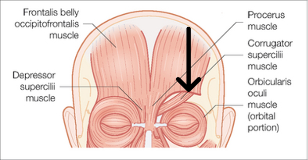 <p>innervation: CN VII</p><p>action: draws eyebrows medially and inferior</p>