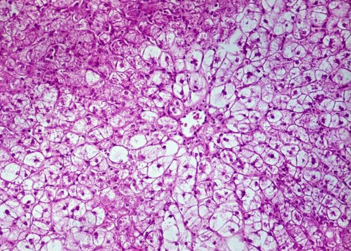 <p>glycogen or lipid inclusions?</p>