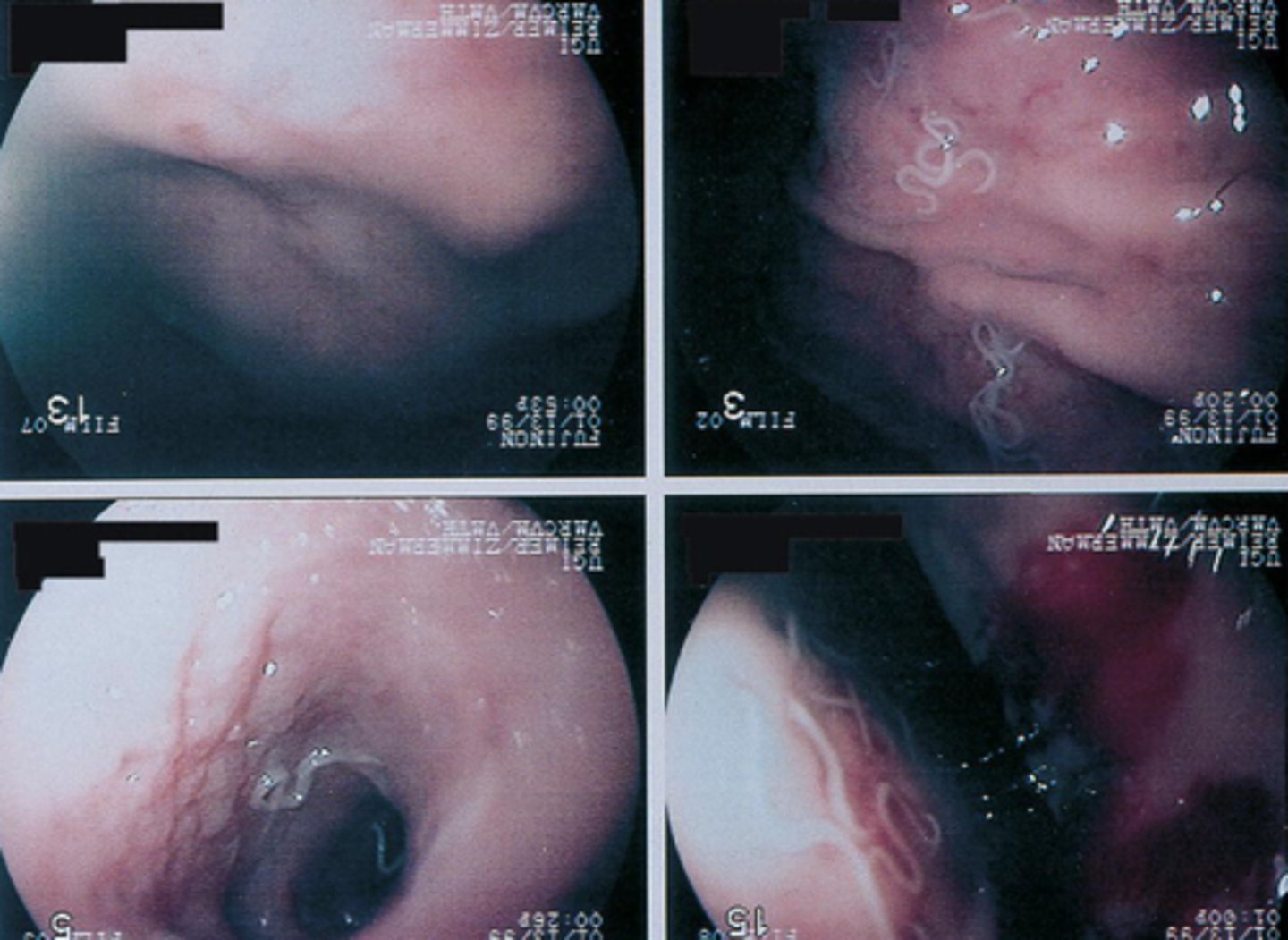 <p>What parasite is this if it is from a dog</p>