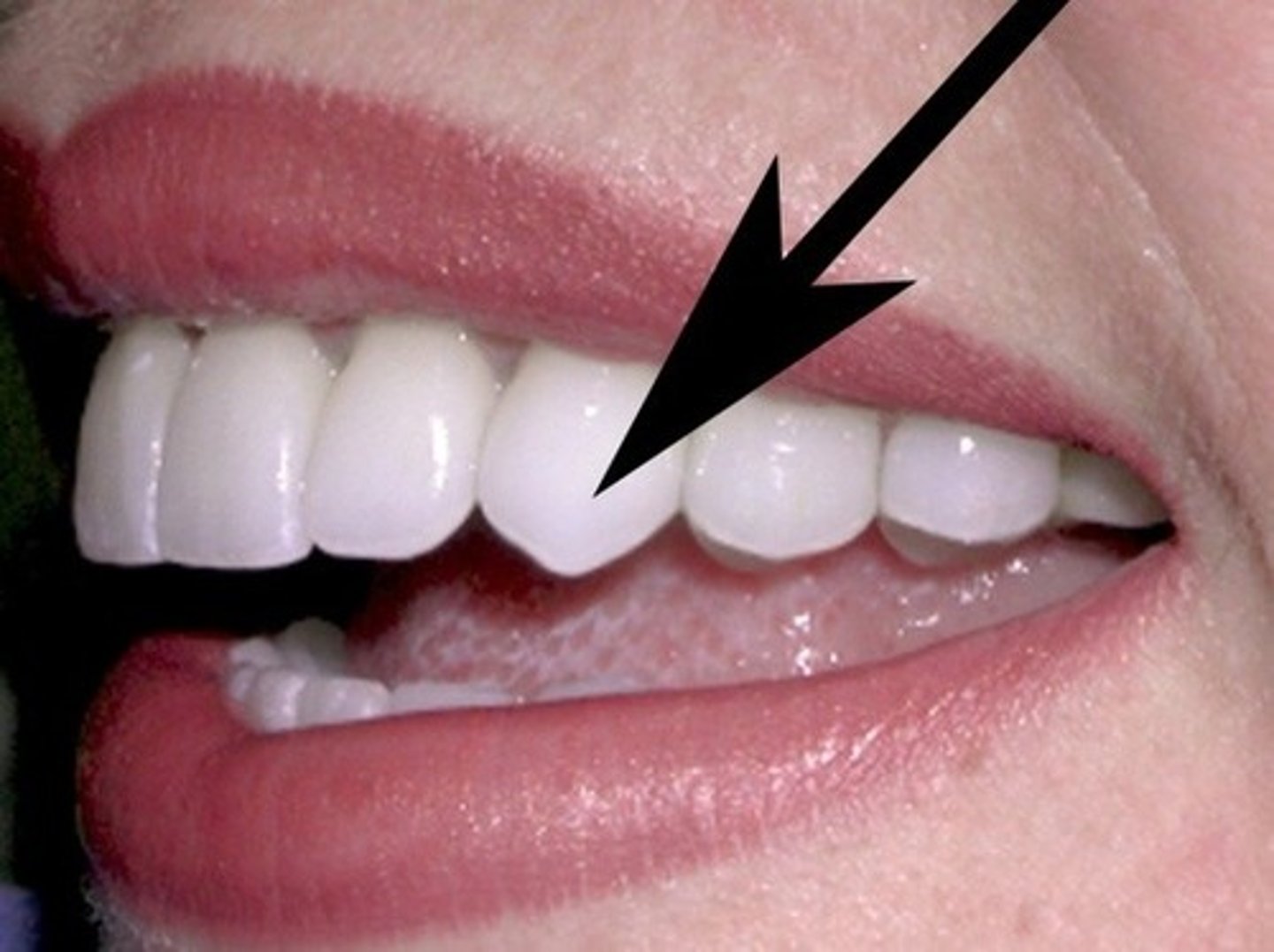 <p>Unicuspid and single-rooted, often for holding and stabbing</p>