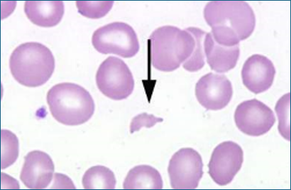<p>The cell swells and eventually burst&nbsp;</p>