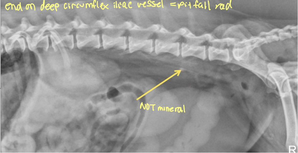 <p>end on deep circumflex iliac vessel</p>