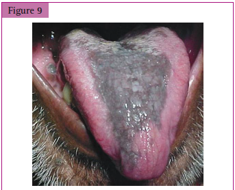 <p>_______________ of tongue with ___________</p>