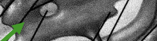 <p>unpaired, located on the midline in diencephalon</p>