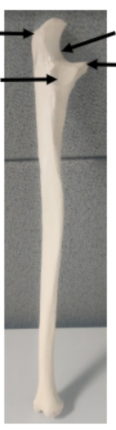 <p>What is this bone?</p>